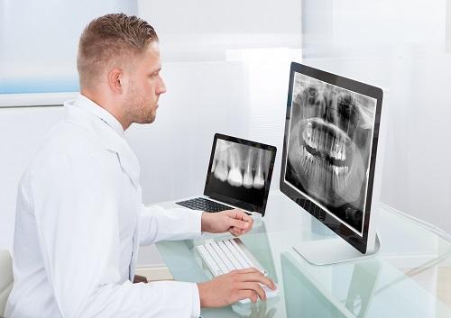 dentist looking at digital dental xrays on a computer