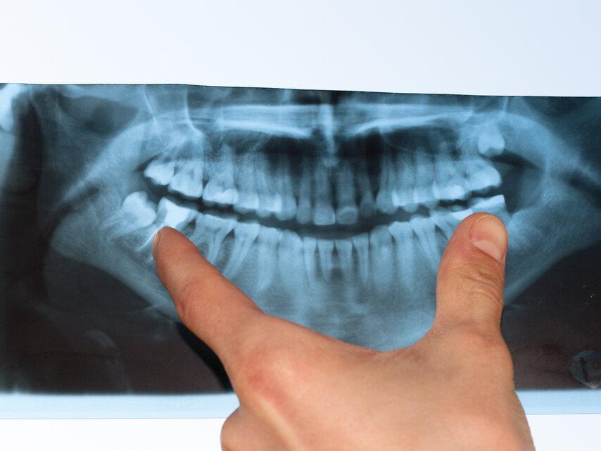 digital xray in Eagle River