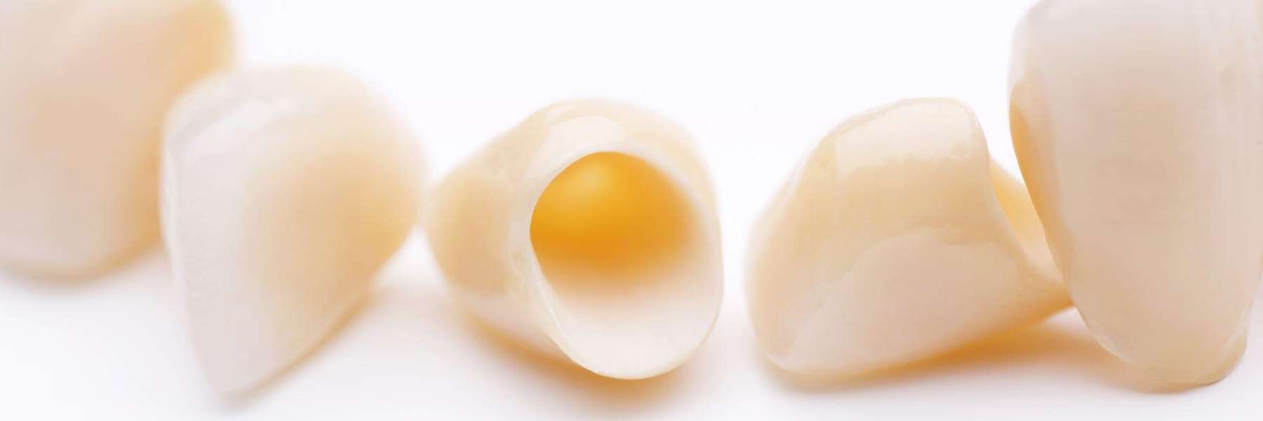 dental crowns
