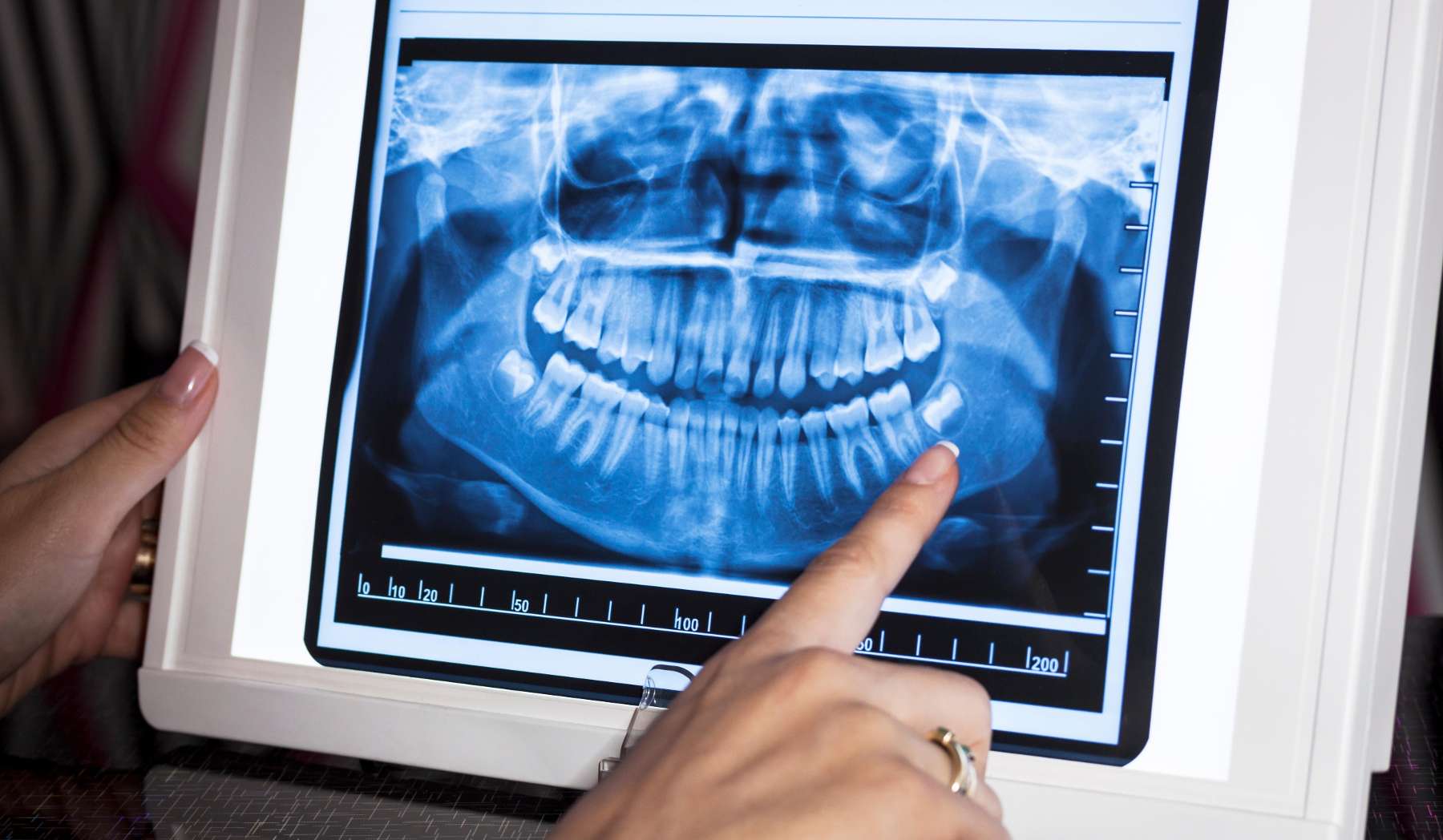 Dental X-Rays Machine