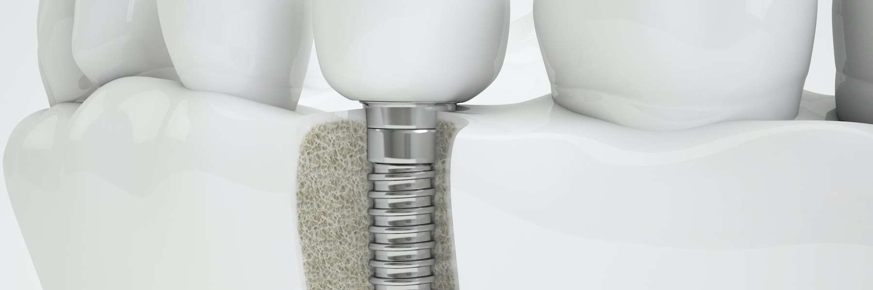 dental cleaning in chugiak ak