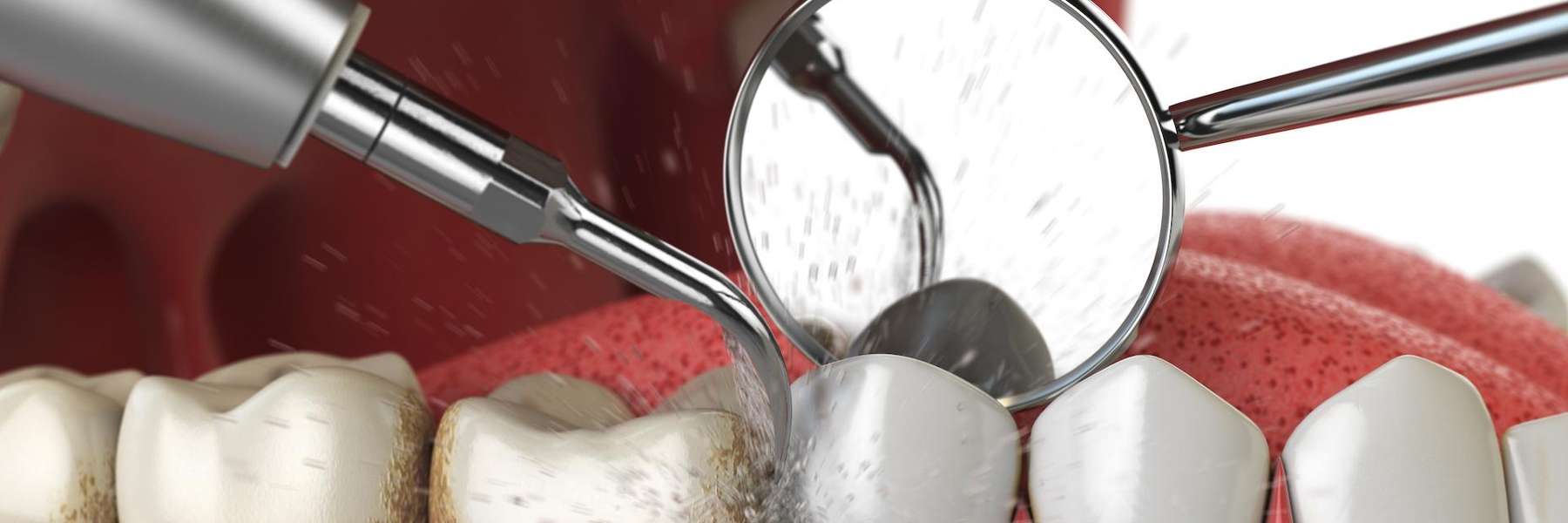 Teeth Cleaning Tool